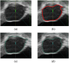 Fig 13