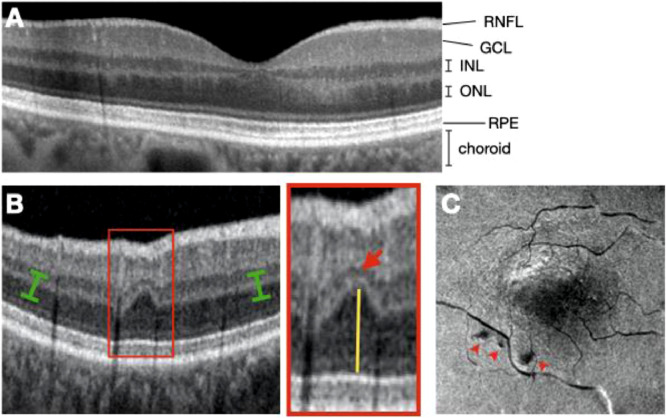 Fig 2