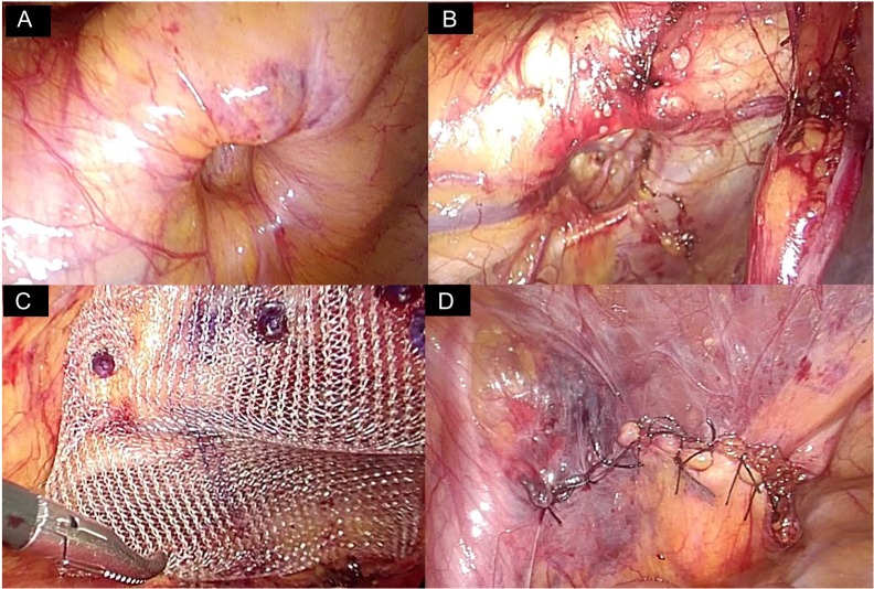 Figure 3: