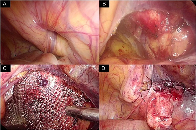 Figure 2: