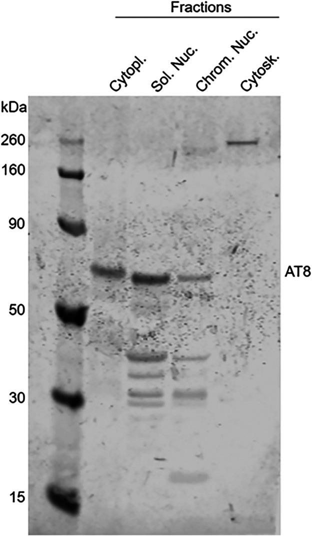 FIGURE 12