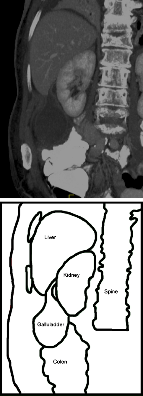 Fig. 1