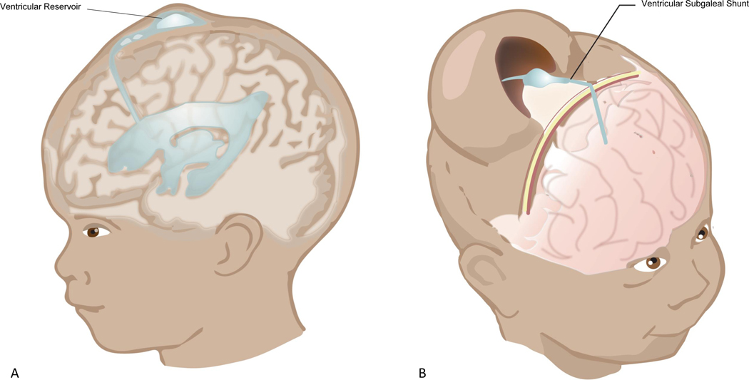 Figure 3;