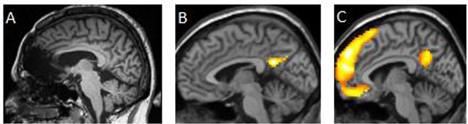 Fig 1.