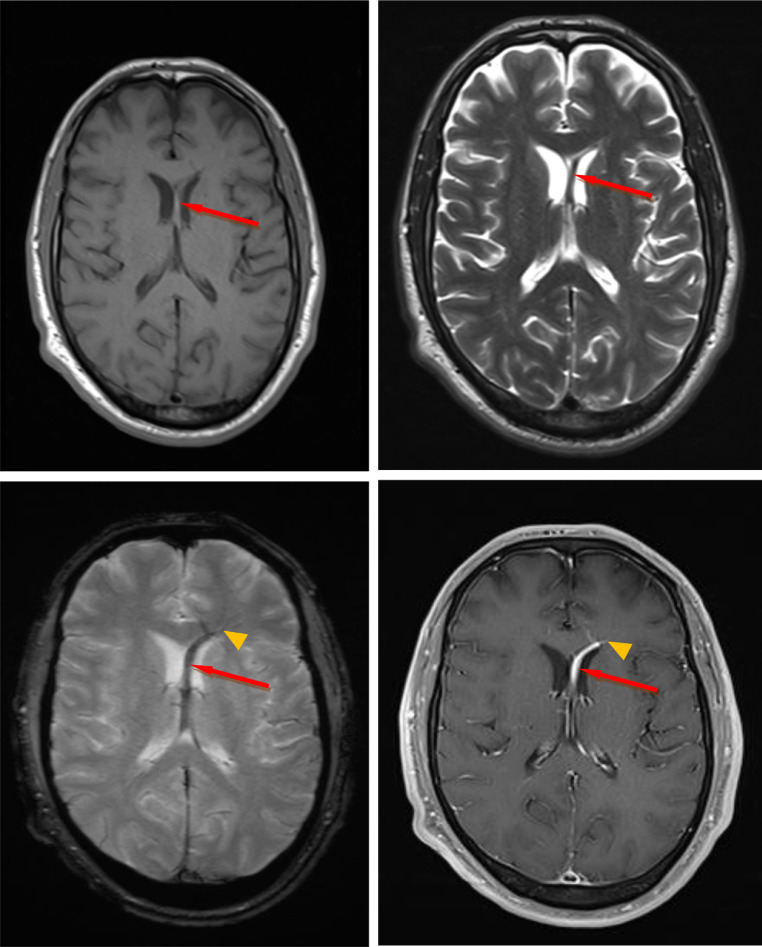 Fig 2 –