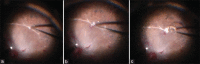 Figure 2: