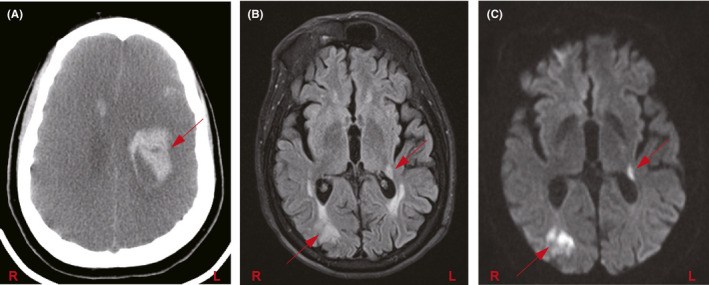 FIGURE 4