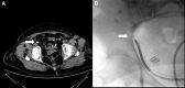 FIG. 4.