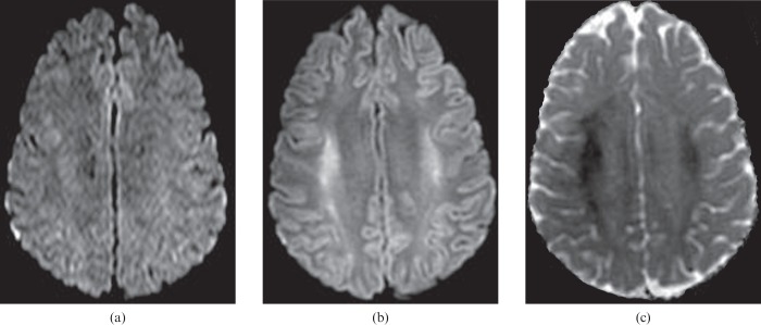 Figure 14