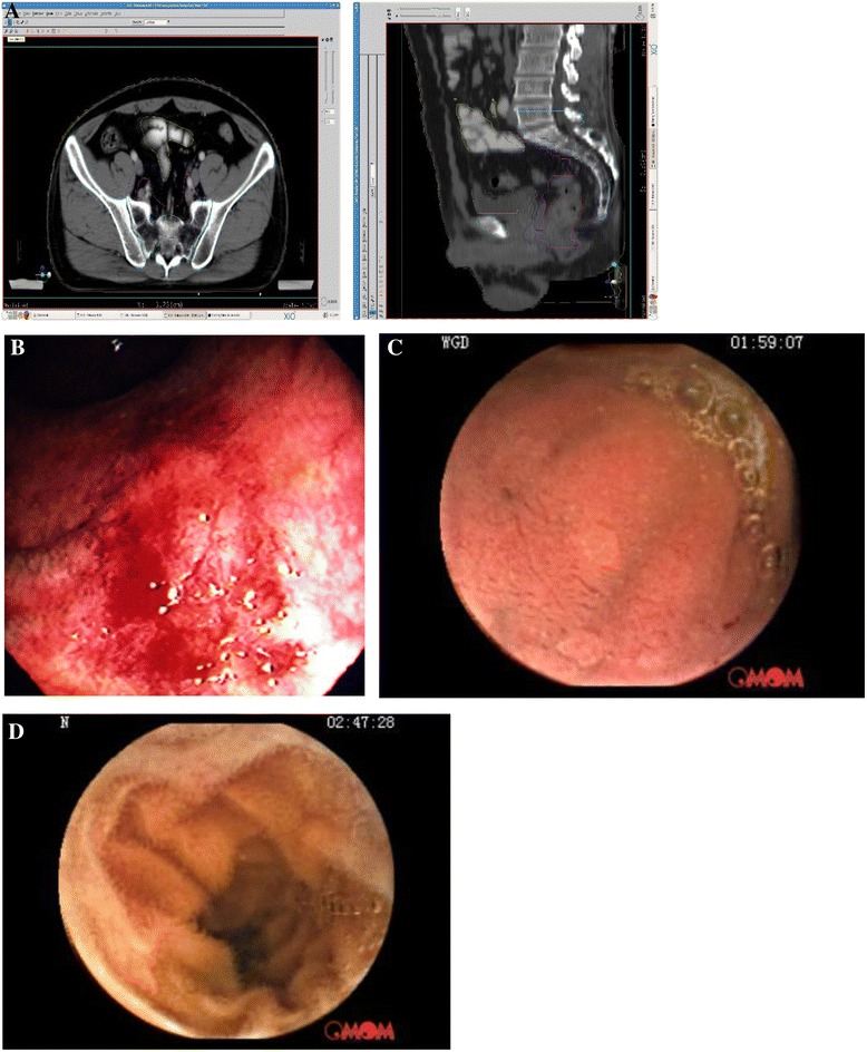 Fig. 1