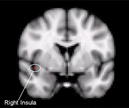 Fig. 1