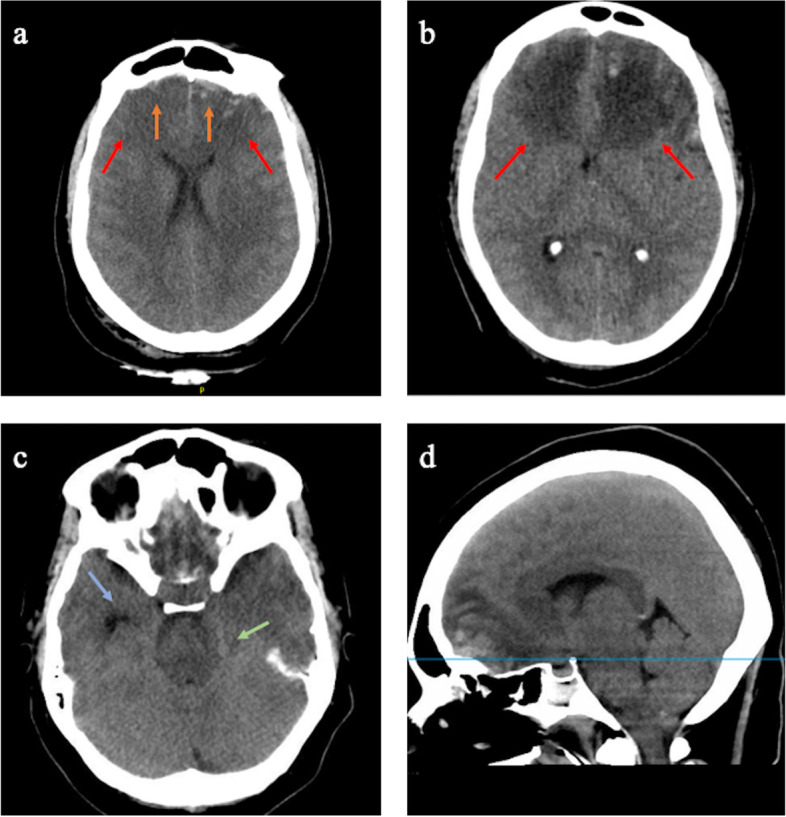 Fig. 1