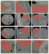 Fig 13