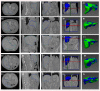 Fig 12