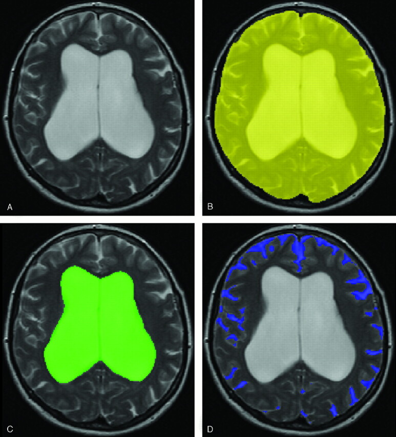 Fig 1.