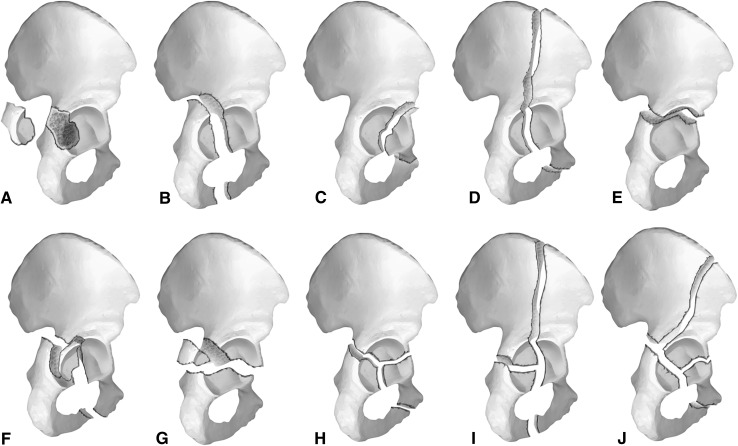 Fig. 1A–J