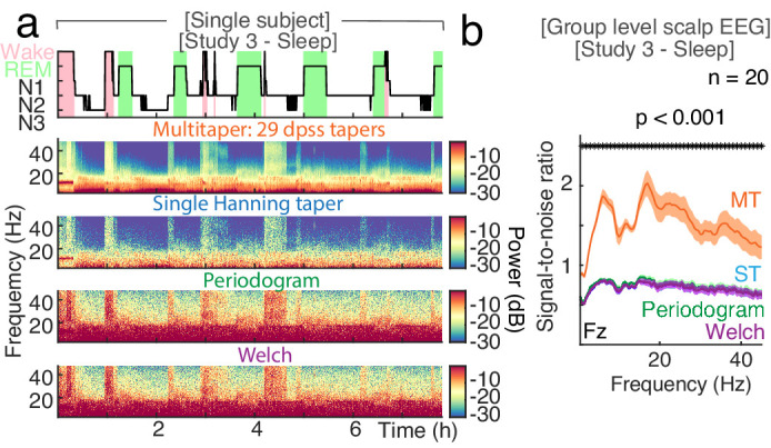 Figure 2—figure supplement 6.