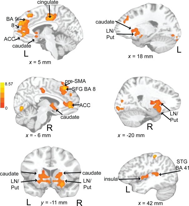 Figure 11