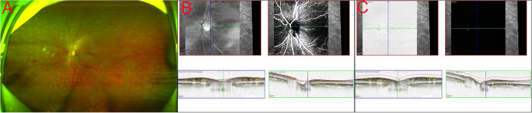 Fig. 2