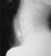 Fig. 2