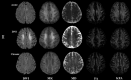 Fig 4.