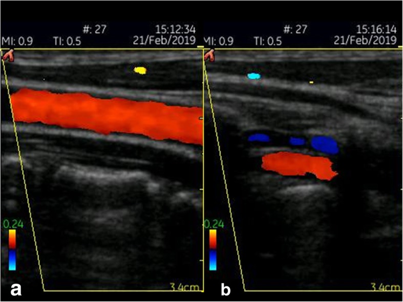 Fig. 4