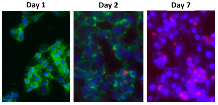 Figure 11