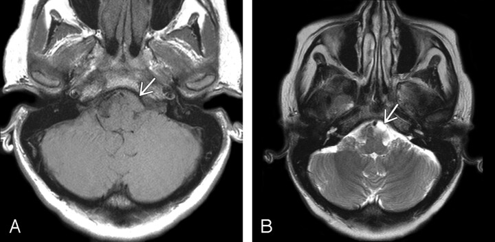 Fig 3.