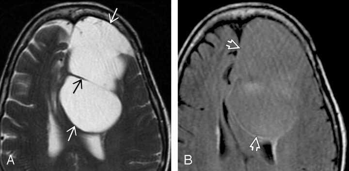 Fig 4.