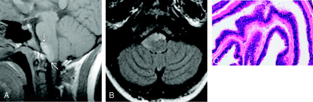 Fig 2.