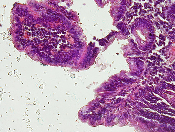 Fig. 2