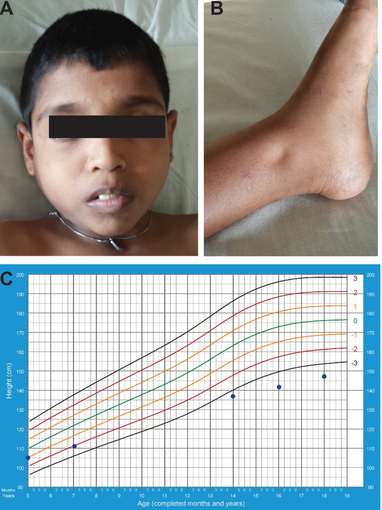 Fig. 1