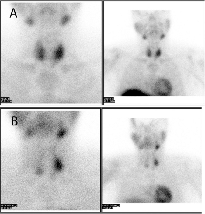 Fig. 2A & B