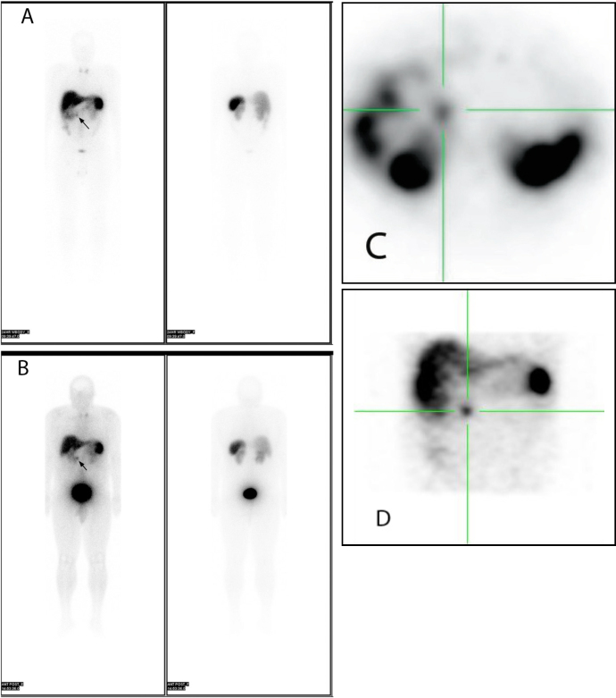 Fig. 3A-D