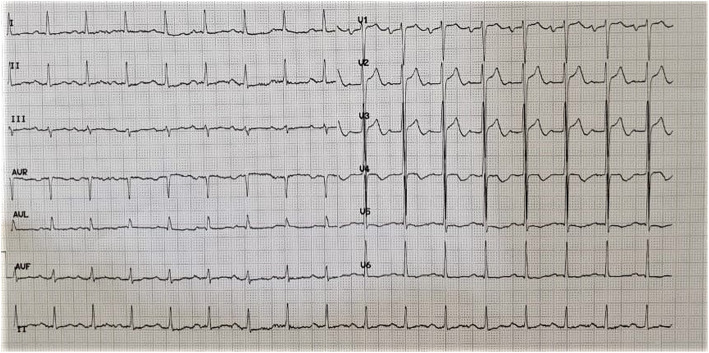 Fig. 4