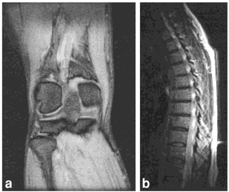 FIG. 11