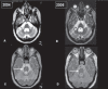 Figure 1 (A-D)