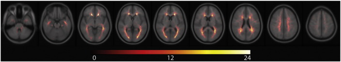 Fig. 1