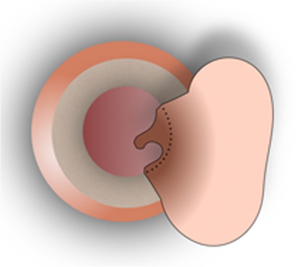 Fig. 2