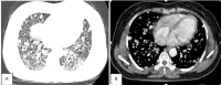 Fig 6 –