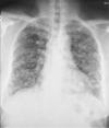 Fig 1 –