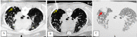 Fig 3 –