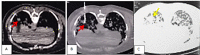Fig 9 –