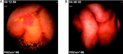 Fig. 2