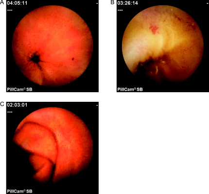 Fig. 1