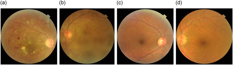 Fig 3