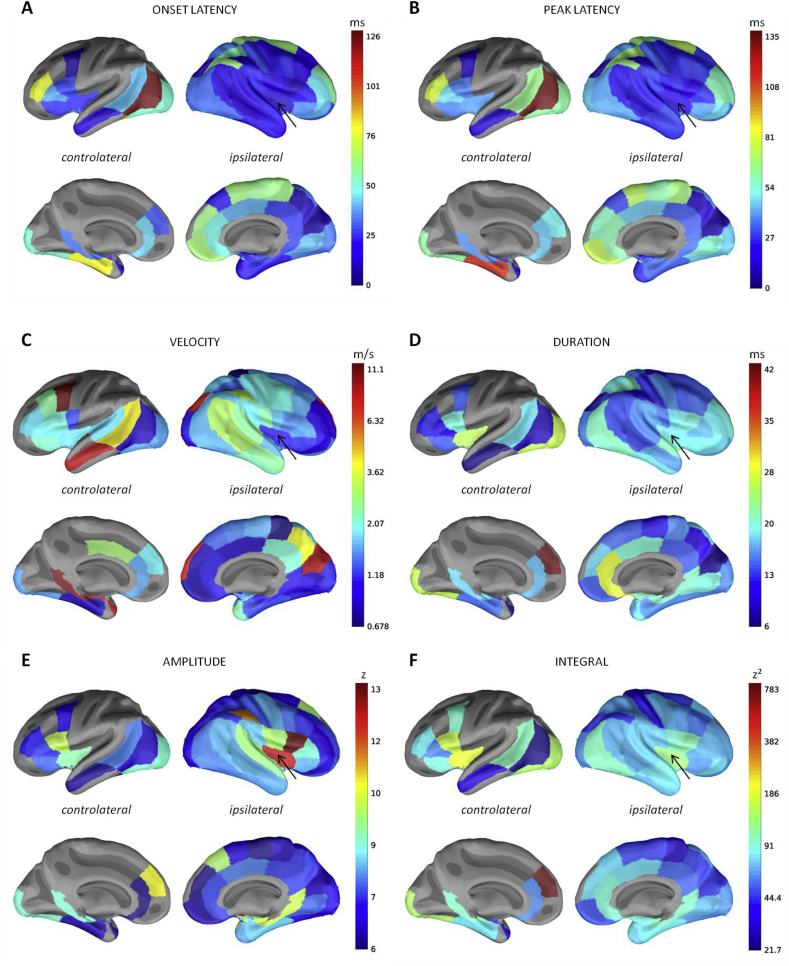 Fig. 11