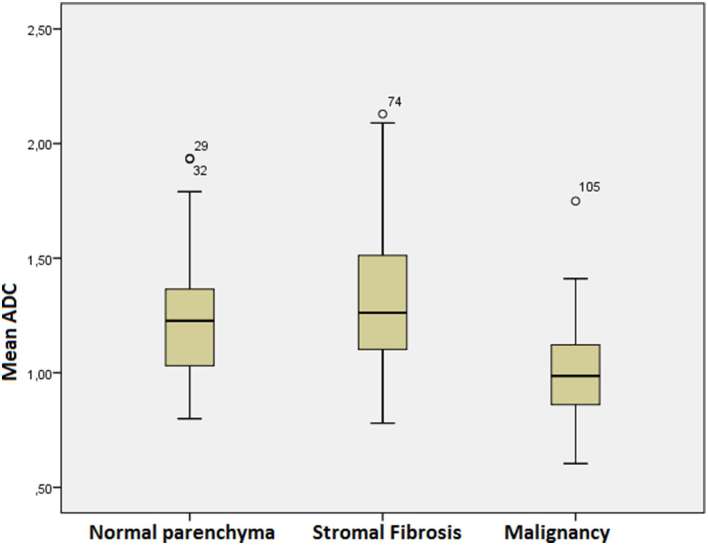 Stromal fibrosis: imaging features with diagnostic contribution of ...