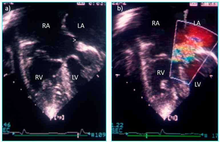 Figure 15