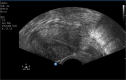 Fig. 11